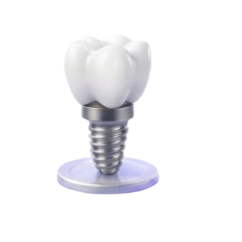 Dental Implants