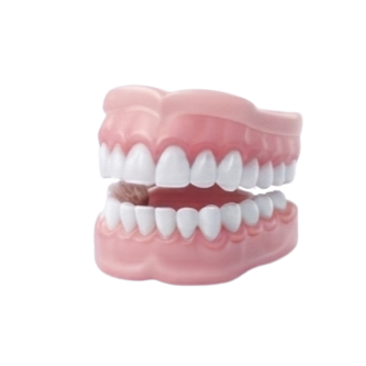 Full Mouth Rehabilitation